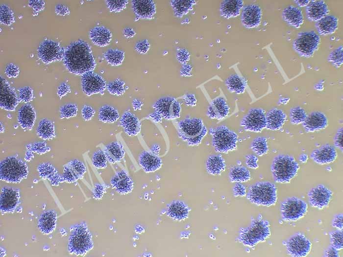 MT-4人急性淋巴母细胞白血病细胞（STR鉴定正确）图2