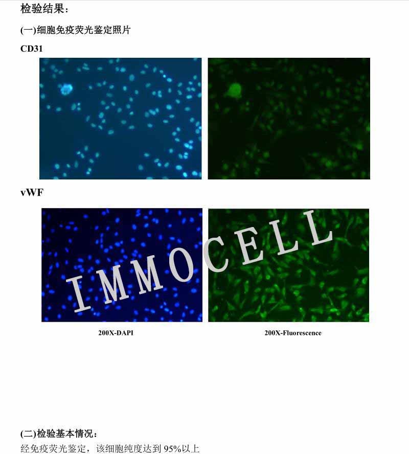 HUVEC人脐静脉内皮细胞（永生化）（免疫荧光鉴定）图2