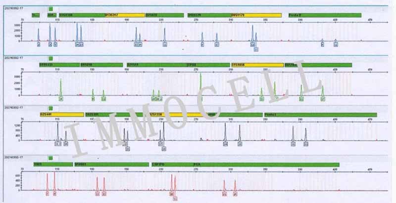 293T人胚肾细胞（STR鉴定正确）图2