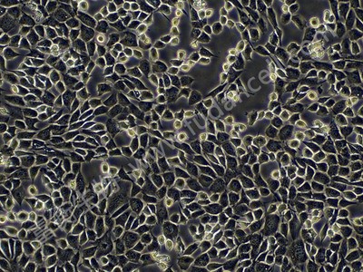 小鼠黑色素瘤细胞;B16BL6图3