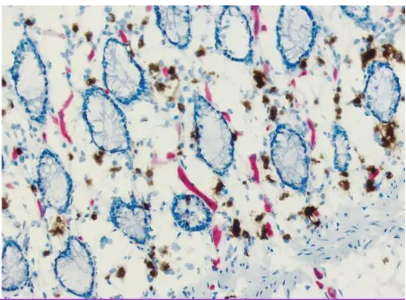 Vector  H-4000 免疫组化笔 IHC PAP PEN图2