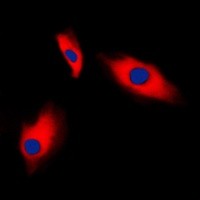 ACTG2 antibody Catalog Number: orb213518图2