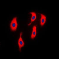 ACTN2 antibody Catalog Number: orb213519图3