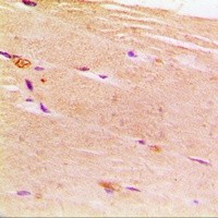 ACTN2 antibody Catalog Number: orb213519图2
