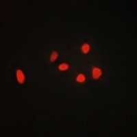 ADD3 antibody Catalog Number: orb213528图2
