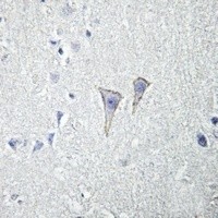 ADORA2A antibody Catalog Number: orb213530图3