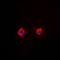 ADORA2A antibody Catalog Number: orb213530图2
