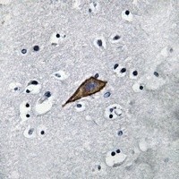 CD13 antibody Catalog Number: orb213554图3