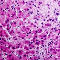 ANXA6 antibody Catalog Number: orb213559图3