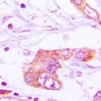 Apolipoprotein E antibody Catalog Number: orb213571图3