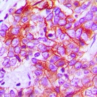 CD95 antibody Catalog Number: orb213574图3