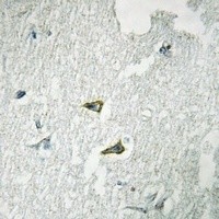 CD95 antibody Catalog Number: orb213575图3