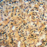 ARF6 antibody Catalog Number: orb213580图2