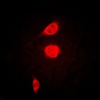 ATF1 antibody Catalog Number: orb213588图3