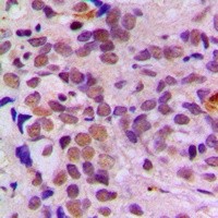ATF1 antibody Catalog Number: orb213588图2