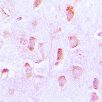 BCL2 antibody Catalog Number: orb213602图2