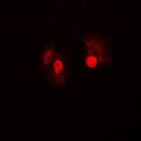 BRAF antibody Catalog Number: orb213615图2