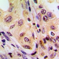 BRAF antibody Catalog Number: orb213615图3