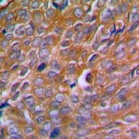 Calnexin (phospho-S583) antibody Catalog Number: orb213636图3