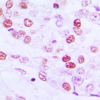 CCNE1 antibody Catalog Number: orb213678图2