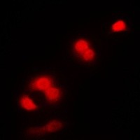 CDK1 antibody Catalog Number: orb213697图2