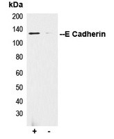 E Cadherin antibody Catalog Number: orb213706图2