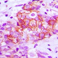 E Cadherin antibody Catalog Number: orb213706图3