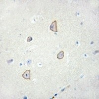 CDH18 antibody Catalog Number: orb213709图2