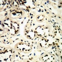 CDK1/2/3 (phospho-T14) antibody Catalog Number: orb213710图3