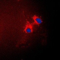 CDKN2B antibody Catalog Number: orb213719图2