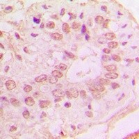 CDKN2B antibody Catalog Number: orb213719图3