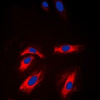 CKM antibody Catalog Number: orb213745图3