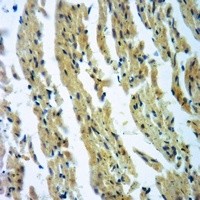 CLCN4 antibody Catalog Number: orb213747图2