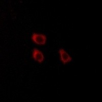 CLCN4 antibody Catalog Number: orb213747图3