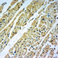 CRP antibody Catalog Number: orb213782图3