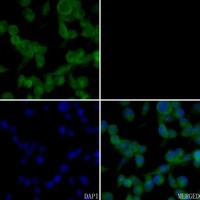 CRP antibody Catalog Number: orb213782图2