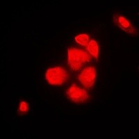CSE1L antibody Catalog Number: orb213784图2