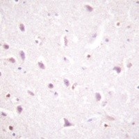 CSNK2B (phospho-S209) antibody Catalog Number: orb213792图3