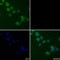 CSNK2B antibody Catalog Number: orb213793图2