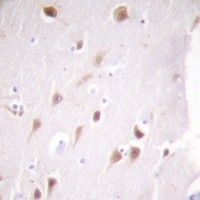 CSNK2B antibody Catalog Number: orb213793图3
