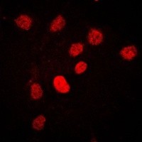 CSTF2 antibody Catalog Number: orb213797图2