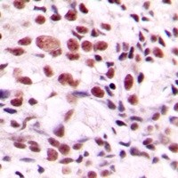 CSTF2 antibody Catalog Number: orb213797图3