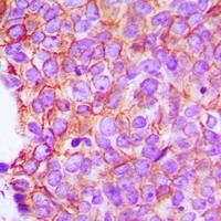 Alpha E-catenin antibody Catalog Number: orb213799图3