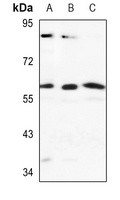 CYP2J2 antibody Catalog Number: orb213827图2