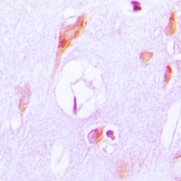 CYP27A1 antibody Catalog Number: orb213835图3
