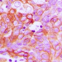 EFNA1 antibody Catalog Number: orb213872图3