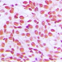EGR2 antibody Catalog Number: orb213880图2