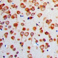 ENO2 antibody Catalog Number: orb213894图3