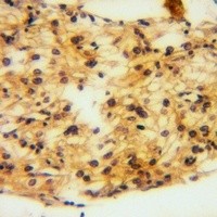 EPHA3 antibody Catalog Number: orb213898图3
