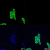 EPHA3 antibody Catalog Number: orb213898图2